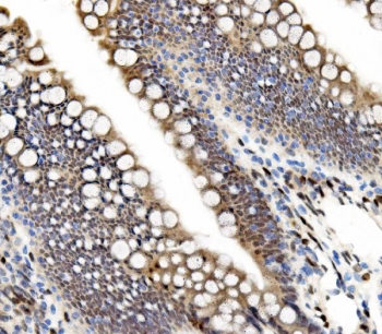 IHC staining of FFPE rat intestine with TEAD2 antibody. HIER: boil tissue sections in pH8 EDTA for 20 min and allow to cool before testing.