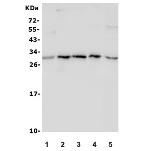 Western blot testing of 1) rat lung, 2) mouse brain, 3) mouse heart, 4) mouse lung and 5) human HepG2 lysate with ULBP1 antibody. Predicted molecular weight ~28 kDa but may be observed at higher molecular weights due to glycosylation.