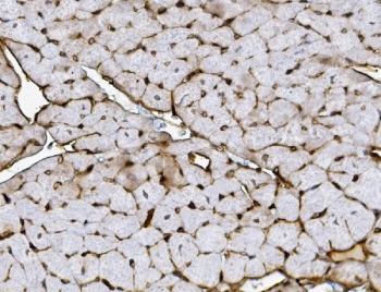 IHC staining of FFPE mouse heart with Xrcc4 antibody. HIER: boil tissue sections in pH8 EDTA for 20 min and allow to cool before testing.