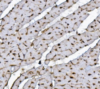 IHC staining of FFPE rat heart with Xrcc4 antibody. HIER: boil tissue sections in pH8 EDTA for 20 min and allow to cool before testing.