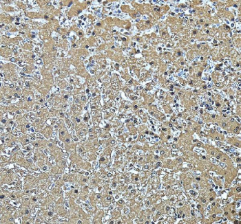 IHC staining of FFPE human liver tissue with ACADSB antibody, HRP-secondary and DAB substrate. HIER: boil tissue sections in pH8 EDTA for 20 min and allow to cool before testing.