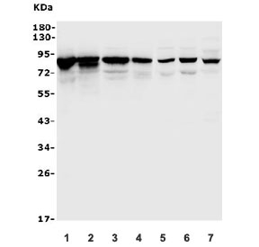 Western blot testing of rat 1) heart, 2) liver, 3) kidney, 4) spleen and mouse 5) spleen, 6) thymus and 7) ANA-1 lysate with Afm antibody. Predicted molecular weight: ~69/87 kDa (unmodified/glycosylated).