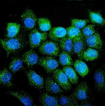 CD38 Antibody human A431 cells IF. Immunofluorescence analysis of CD38 / plasma cell marker expression in FFPE human A431 cells using a CD38 antibody (green). Signal is observed predominantly along the cell membrane and within the cytoplasm, outlining individual cells with a punctate to diffuse staining pattern, while nuclei are counterstained with DAPI (blue). The staining demonstrates cell surface-associated localization consistent with CD38 expression, with clear contrast between positive signal and nuclear regions. HIER was performed by steaming tissue sections in pH 6 citrate buffer for 20 minutes prior to antibody incubation.