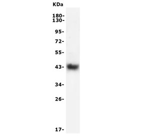 CD38 Antibody human Raji lysate WB. Western blot analysis of CD38 / plasma cell marker expression in human Raji cell lysate using a CD38 antibody. A band is detected at approximately 40â45 kDa, consistent with the predicted molecular weight of CD38, with slight upward shift reflecting glycosylation of this cell surface protein. The observed band aligns with known expression of CD38 in B cell-derived lines.
