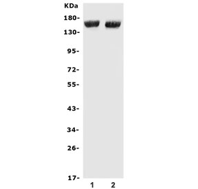 Western blot testing of 1) mouse liver and 2) rat liver lysate with Cfh antibody. Predicted molecular weight ~139 kDa but may be observed at a higher molecular weight due to glycosylation.