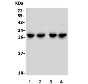 Western blot testing of 1) mouse liver, 2) mouse kidney, 3) rat liver and 4) rat kidney lysate with CMBL antibody. Predicted molecular weight ~28 kDa.