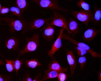 CRYAB Antibody Cytoplasmic IF. Immunofluorescence analysis of Alpha B crystallin / CRYAB in FFPE human U-2 OS cells using polyclonal CRYAB antibody. Red fluorescence highlights cytoplasmic distribution of CRYAB consistent with stress-responsive chaperone and anti-apoptotic function, while nuclei are counterstained with DAPI (blue). Heat induced epitope retrieval was performed by steaming sections in pH 6 citrate buffer for 20 min prior to staining.