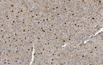 CRYAB Antibody Neural Tissue IHC. Immunohistochemistry of Alpha B crystallin / CRYAB in FFPE mouse brain tissue using polyclonal CRYAB antibody. HRP-DAB brown staining highlights scattered cytoplasmic labeling in neuronal and glial cells with a diffuse distribution, consistent with stress-response and protein stabilization functions in neural tissue, while surrounding parenchyma shows low background and nuclei are counterstained blue. Heat induced epitope retrieval was performed by boiling tissue sections in pH 8 EDTA for 20 min followed by cooling prior to staining.