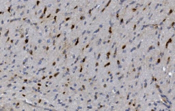 CRYAB Antibody Rat Neural IHC. Immunohistochemistry of Alpha B crystallin / CRYAB in FFPE rat brain tissue using polyclonal CRYAB antibody. HRP-DAB brown staining highlights scattered cytoplasmic labeling in neuronal and glial cells with a diffuse pattern, consistent with stress-responsive and anti-apoptotic protein expression in neural tissue, while surrounding parenchyma shows low background and nuclei are counterstained blue. Heat induced epitope retrieval was performed by boiling tissue sections in pH 8 EDTA for 20 min followed by cooling prior to staining.