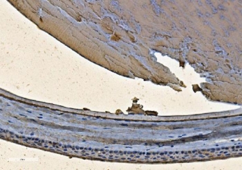 CRYAB Antibody Ocular Tissue IHC. Immunohistochemistry of Alpha B crystallin / CRYAB in FFPE rat eyeball tissue using polyclonal CRYAB antibody. HRP-DAB brown staining highlights cytoplasmic labeling within retinal and lens-associated cellular layers, consistent with stress-responsive and anti-apoptotic protein expression in ocular tissue, while surrounding structures show lower background staining and nuclei are counterstained blue. Heat induced epitope retrieval was performed by boiling tissue sections in pH 8 EDTA for 20 min followed by cooling prior to staining.