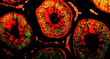 Immunofluorescent staining of FFPE rat testis with DR1 antibody (green). HIER: boil tissue sections in pH8 EDTA for 20 min and allow to cool before testing.