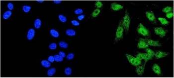 Immunofluorescent staining of FFPE human U-2 OS cells with HDAC5 antibody (green) and DAPI nuclear stain (blue). HIER: steam section in pH6 citrate buffer for 20 min.