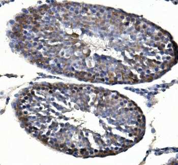 IHC staining of FFPE rat testis with polyclonal Inhibin alpha antibody. HIER: boil tissue sections in pH8 EDTA for 20 min and allow to cool before testing.