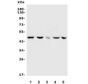 Inhibin alpha Antibody Rabbit Polyclonal western blot analysis. Western blot testing of human and rodent lysates using Inhibin alpha Antibody Rabbit Polyclonal. Lane 1: human K562 lysate, Lane 2: human HeLa lysate, Lane 3: rat brain lysate, Lane 4: mouse spleen lysate, Lane 5: mouse SP2/0 lysate. A band is detected at approximately 40 kDa, consistent with the predicted molecular weight of Inhibin subunit alpha (INHA).