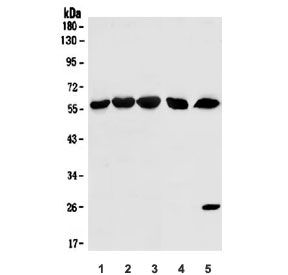 Western blot testing of 1) human HL-60, 2) Caco-2, 3) human PC-3, 4) rat heart and 5) mouse heart lysate with KPNA1 antibody. Predicted molecular weight ~60 kDa.