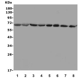 Western blot testing of human 1) Jurkat, 2) HeLa, 3) HEK293, 4) HepG2, 5) U-2 OS, 6) rat thymus, 7) mouse thymus and 8) mouse SP2/0 lysate with MBD1 antibody. Predicted molecular weight ~67 kDa.