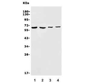 Western blot testing of 1) human HEK293, 2) human HeLa, 3) mouse skeletal muscle and 4) mouse lung lysate with SLC22A3 antibody. Predicted molecular weight: ~61 kDa.
