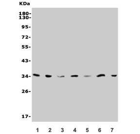 Western blot testing of human 1) HepG2, 2) Jurkat, 3) K562, 4) A549, 5) rat liver, 6) RH35 and 7) mouse HEPA1-6 lysate with SLC25A1 antibody. Predicted molecular weight ~34 kDa, commonly observed at 30-34 kDa.