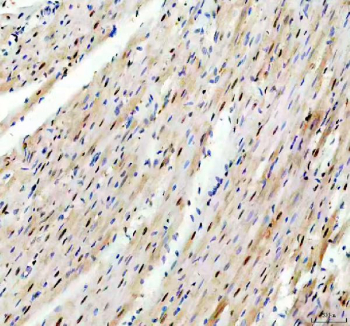IHC staining of FFPE rat heart tissue with TRIM63 antibody, HRP-secondary and DAB substrate. HIER: boil tissue sections in pH8 EDTA for 20 min and allow to cool before testing.