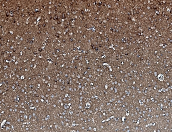 IHC staining of FFPE rat brain with PPP2CA antibody. HIER: boil tissue sections in pH8 EDTA for 20 min and allow to cool before testing.