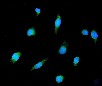 GAD2 Antibody HeLa Immunofluorescence. Immunofluorescent analysis of formalin-fixed human HeLa cells stained with GAD2 Antibody clone 7G2 demonstrates diffuse cytoplasmic green fluorescence consistent with Glutamate decarboxylase 2 / GAD65-associated inhibitory neurotransmitter synthesis pathways. This Glutamate decarboxylase 2 antibody highlights GABA synthesis-associated signaling and neuronal enzyme expression patterns within epithelial-derived cells. Nuclei are counterstained with DAPI nuclear stain (blue). Heat-induced epitope retrieval was performed by steaming sections in pH 6 citrate buffer for 20 min prior to antibody incubation.