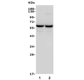 Western blot of GAD65 Antibody Mouse Monoclonal 4E12. Lane 1: rat brain lysate, Lane 2: mouse brain lysate. A band is detected at approximately 65 kDa, consistent with the predicted molecular weight of Glutamate decarboxylase 2 / GAD65. The strong signal in brain lysates aligns with the known neuronal enrichment of this GABA-synthesizing enzyme.