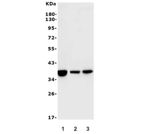 Western blot testing of 1) rat liver, 2) mouse liver and 3) monkey liver lysate with ARG1 antibody. Predicted molecular weight ~35 kDa.