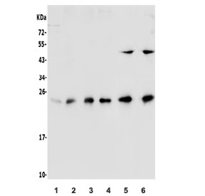 Western blot testing of human 1) U-87 MG, 2) K562, 3) Jurkat, 4) Raji, 5) rat PC-12 and 6) mouse SP2/0 lysate with HP1 alpha antibody. Predicted molecular weight ~22 kDa.