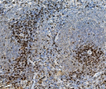 CD8A Antibody Rat Spleen IHC. Immunohistochemistry staining of FFPE rat spleen with Cd8a antibody. HIER: boil tissue sections in pH8 EDTA for 20 min and allow to cool before testing.