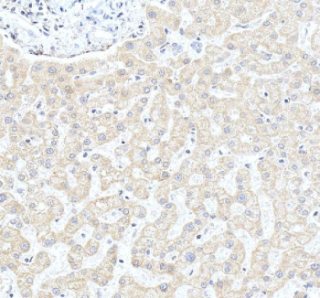 IHC staining of FFPE human liver tissue with CYP27A1 antibody, HRP-secondary and DAB substrate. HIER: boil tissue sections in pH8 EDTA for 20 min and allow to cool before testing.
