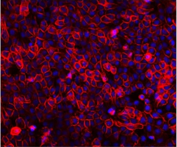EGF Receptor Antibody for IF A431 Staining. Immunofluorescence analysis of FFPE human A431 cells stained with EGF receptor antibody detecting EGFR (red). Prominent membranous staining outlines epithelial cell borders with additional cytoplasmic signal, consistent with EGFR localization as a receptor tyrosine kinase and its trafficking following activation. The staining highlights dense epithelial cell populations typical of A431 cells, which are known to express high levels of EGFR. DAPI nuclear stain (blue) highlights nuclei. HIER: steam section in pH 6 citrate buffer for 20 min.