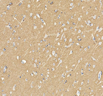IHC staining of FFPE human brain tissue with GAP43 antibody. HIER: boil tissue sections in pH8 EDTA for 20 min and allow to cool before testing.