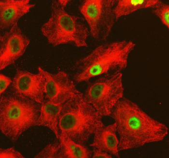 Immunofluorescent staining of FFPE human A549 cells with NFAT5 antibody (green) and Alpha Tubulin mAb (red). HIER: steam section in pH6 citrate buffer for 20 min.