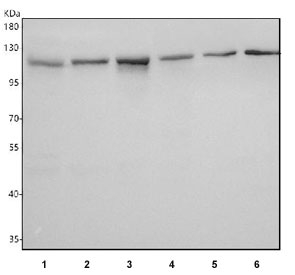 Western blot testing of 1) human HeLa, 2) human SiHa, 3) monkey kidney, 4) pig kidney, 5) rat kidney and 6) mouse kidney tissue lysate with NNT antibody. Predicted molecular weight ~114 kDa.