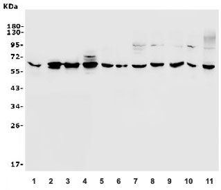 Western blot testing of human 1) placenta, 2) SW579, 3) A431, 4) U-2 OS, 5) rat thymus, 6) rat ovary, 7) rat lung, 8) mouse thymus, 9) mouse ovary, 10) mouse lung and 11) mouse SP2/0 lysate with PAX1 antibody. Expected molecular weight: 45-55 kDa.