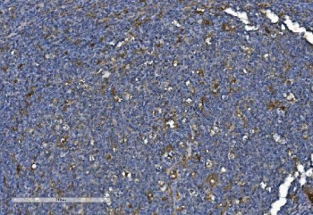 IHC staining of FFPE human tonsil with PNPT1 antibody. HIER: boil tissue sections in pH8 EDTA for 20 min and allow to cool before testing.
