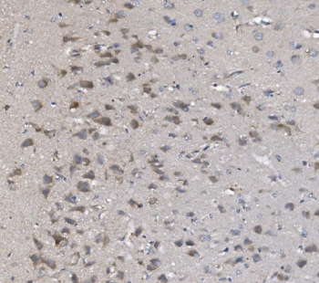 IHC staining of FFPE rat brain with PNPT1 antibody. HIER: boil tissue sections in pH8 EDTA for 20 min and allow to cool before testing.