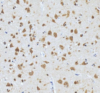 IHC staining of FFPE human brain tissue with PRMT8 antibody. HIER: boil tissue sections in pH8 EDTA for 20 min and allow to cool before testing.