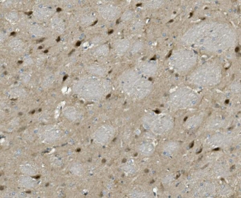 IHC staining of FFPE rat brain with PRMT8 antibody. HIER: boil tissue sections in pH8 EDTA for 20 min and allow to cool before testing.