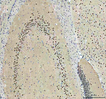 IHC staining of FFPE rat brain with PRMT8 antibody. HIER: boil tissue sections in pH8 EDTA for 20 min and allow to cool before testing.