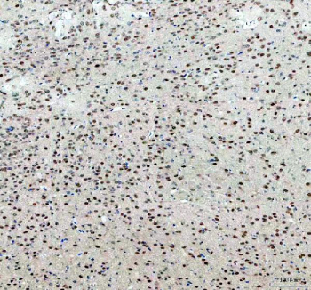 IHC staining of FFPE mouse brain with PRMT8 antibody. HIER: boil tissue sections in pH8 EDTA for 20 min and allow to cool before testing.