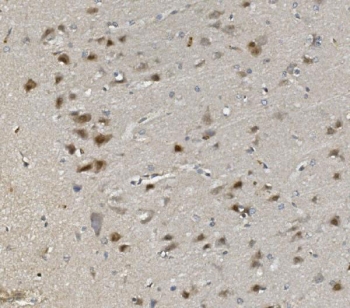 IHC staining of FFPE rat brain with Rad9b antibody. HIER: boil tissue sections in pH8 EDTA for 20 min and allow to cool before testing.