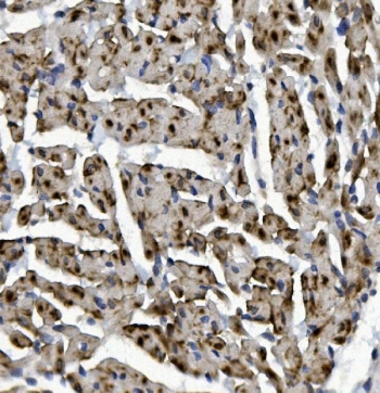 IHC staining of FFPE rat heart with Rad9b antibody. HIER: boil tissue sections in pH8 EDTA for 20 min and allow to cool before testing.