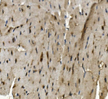 IHC staining of FFPE mouse heart with Rad9b antibody. HIER: boil tissue sections in pH8 EDTA for 20 min and allow to cool before testing.