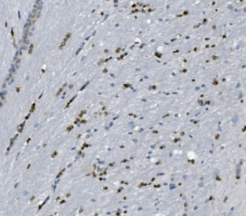 IHC staining of FFPE rat brain with Transketolase antibody. HIER: boil tissue sections in pH8 EDTA for 20 min and allow to cool before testing.