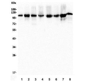 Western blot testing of human 1) HeLa, 2) PC-3, 3) HEK293, 4) A549, 5) Jurkat, 6) ThP-1, 7) rat PC-12 and 8) mouse NIH 3T3 lysate with TRIM28 antibody. Observed molecular weight: 88~110 kDa depending on sumoylation.