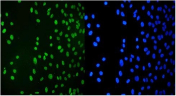 Immunofluorescent staining of FFPE human U-2 OS cells with TRIM28 antibody (green) and DAPI nuclear stain (blue). HIER: steam section in pH6 citrate buffer for 20 min.