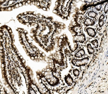 IHC staining of FFPE rat intestine with DDX5 antibody. HIER: boil tissue sections in pH8 EDTA for 20 min and allow to cool before testing.