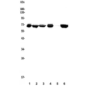Western blot testing of human 1) HeLa, 2) SW620, 3) Caco-2, 4) K562, 5) rat PC-12 and 6) mouse NIH 3T3 lysate with DDX5 antibody. Predicted molecular weight: ~68 kDa.