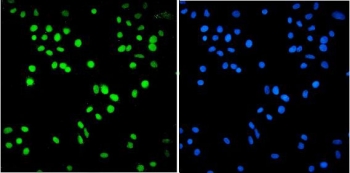 Immunofluorescent staining of FFPE human A549 cells with BRM antibody (green) and DAPI nuclear stain (blue). HIER: steam section in pH6 citrate buffer for 20 min.